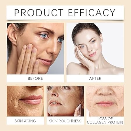 BOTOX CREAM 20 GM(PACK OF 2)